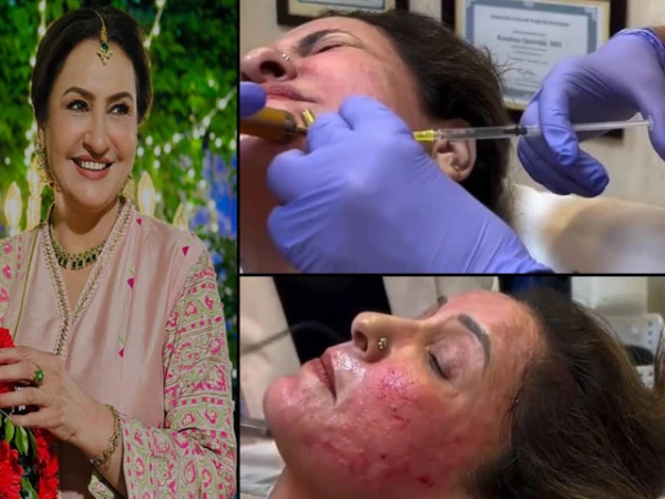 جواں سال نظر آنے کیلیے صبا فیصل کی کاسمیٹک ٹریٹمنٹ کی تصاویر وائرل؛ کڑی تنقید